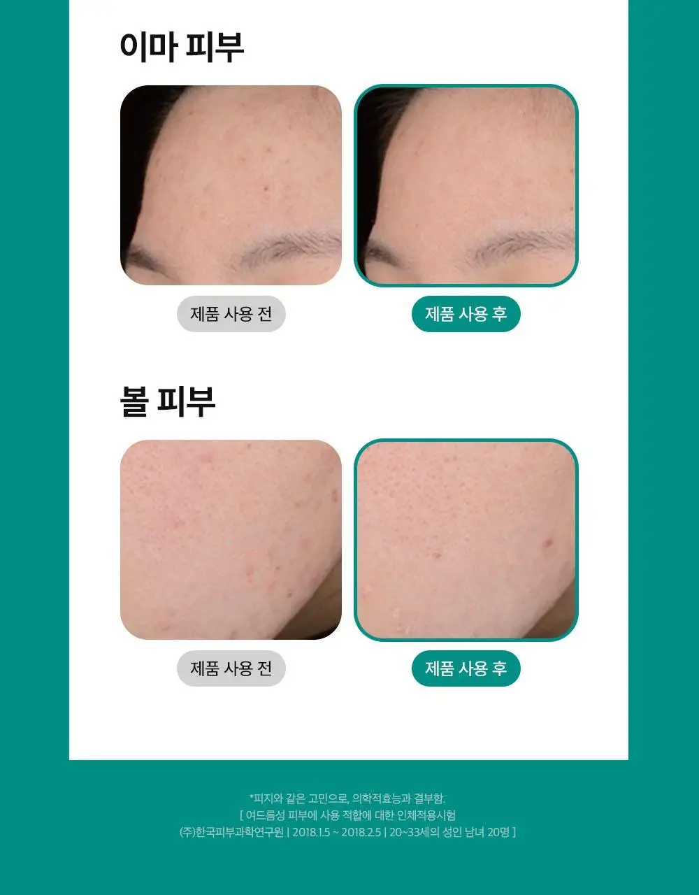 [리뉴얼] 니들리 스팟 클리어 12패치 1+1 기획 (12+12패치) 상세페이지 20